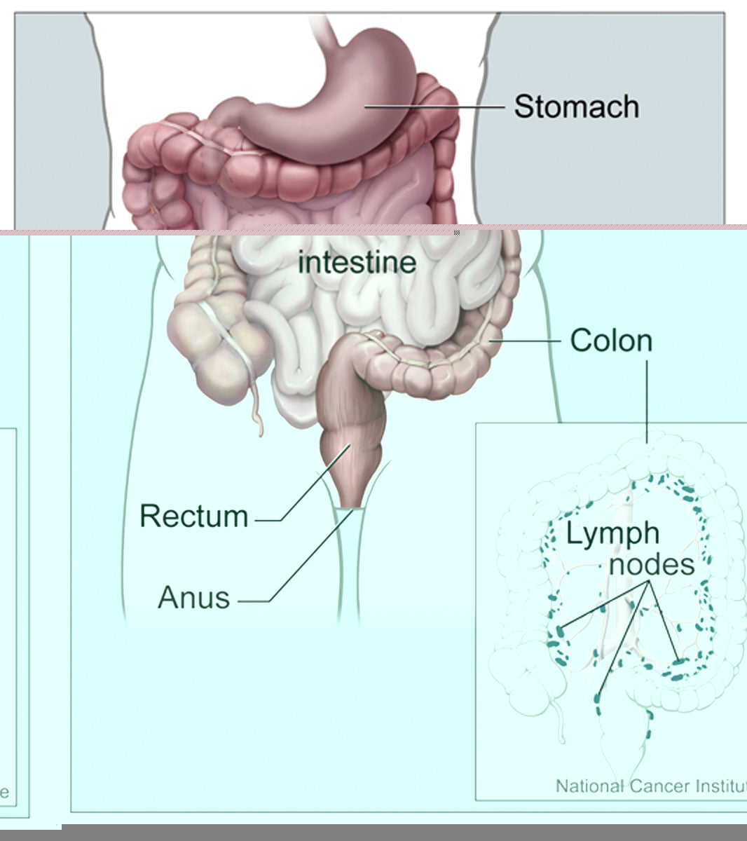 National Cancer Institute medical illustration of the colon and rectum with surrounding digestive organs and nearby lymph nodes; illustrative image, not a SOLARIS trial participant or study specimen.