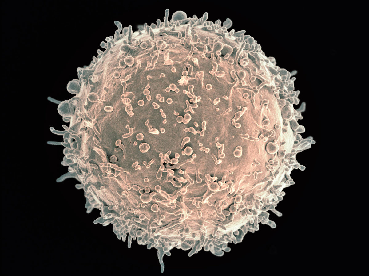 Colorized scanning electron micrograph of a human B lymphocyte, used illustratively for B-cell acute lymphoblastic leukemia coverage; not a trial participant or study specimen.