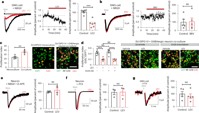 Figure 5 from Barron et al., Nature Medicine (2026), showing that levetiracetam reduces GABAergic neuron-to-glioma synaptic currents in diffuse midline glioma experimental models.