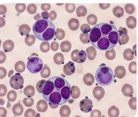 Peripheral blood smear microscopy illustrating ASCP MLS and MLT certification exam preparation.