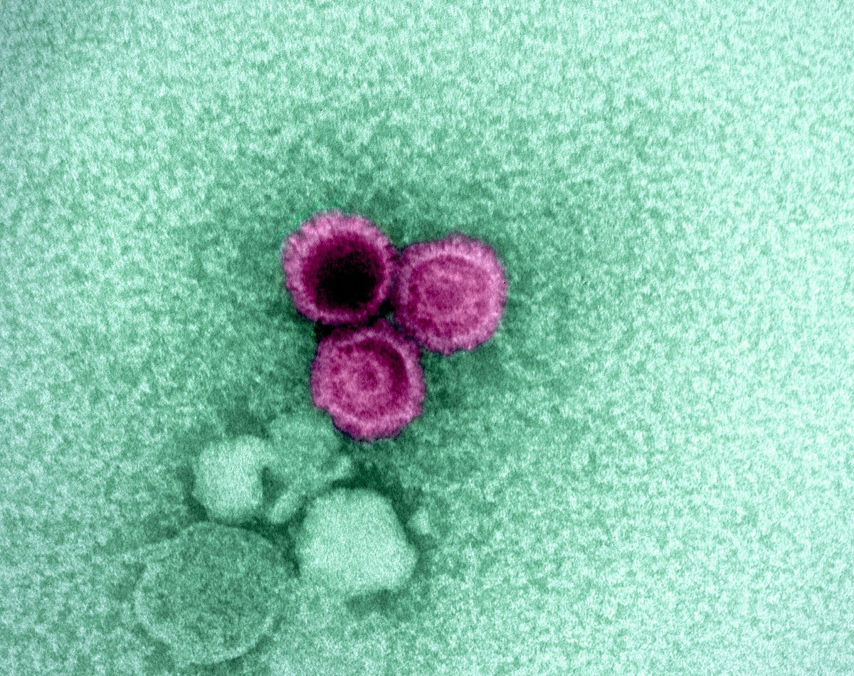 Colorized electron micrograph of three Epstein-Barr virus particles, used as the featured image for a Soleil Research article on EBV-linked immune changes preceding multiple sclerosis relapse. Image credit: NIAID.
