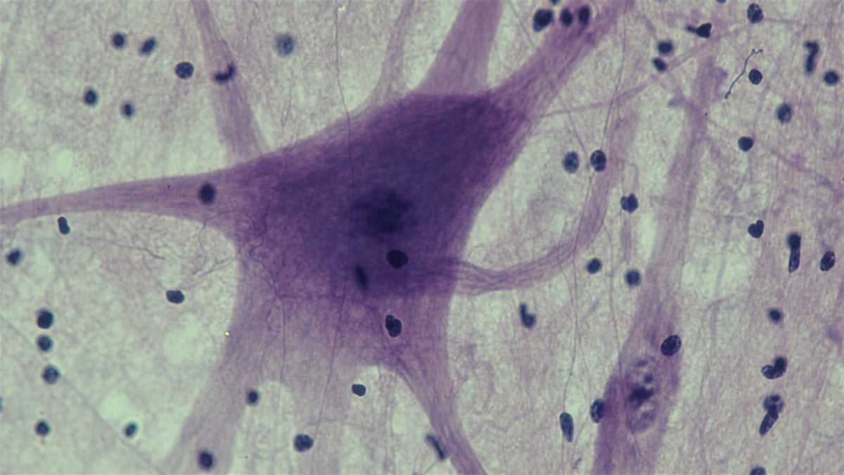 Microscopy image of a spinal cord motor neuron in a stained tissue smear at 400× magnification. Illustrative image, not a specimen from the ALS blood biomarker study.