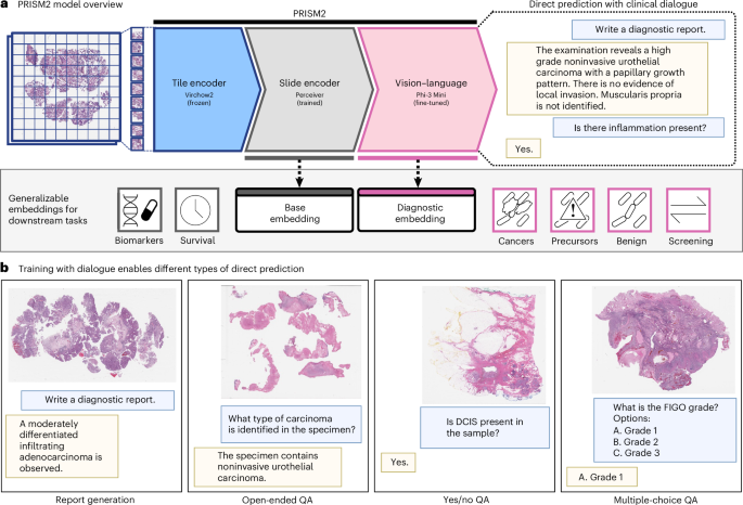 Overview of the PRISM2 multimodal pathology foundation model and clinical dialogue prediction tasks from Vorontsov et al., Nature Medicine 2026, used under CC BY 4.0.